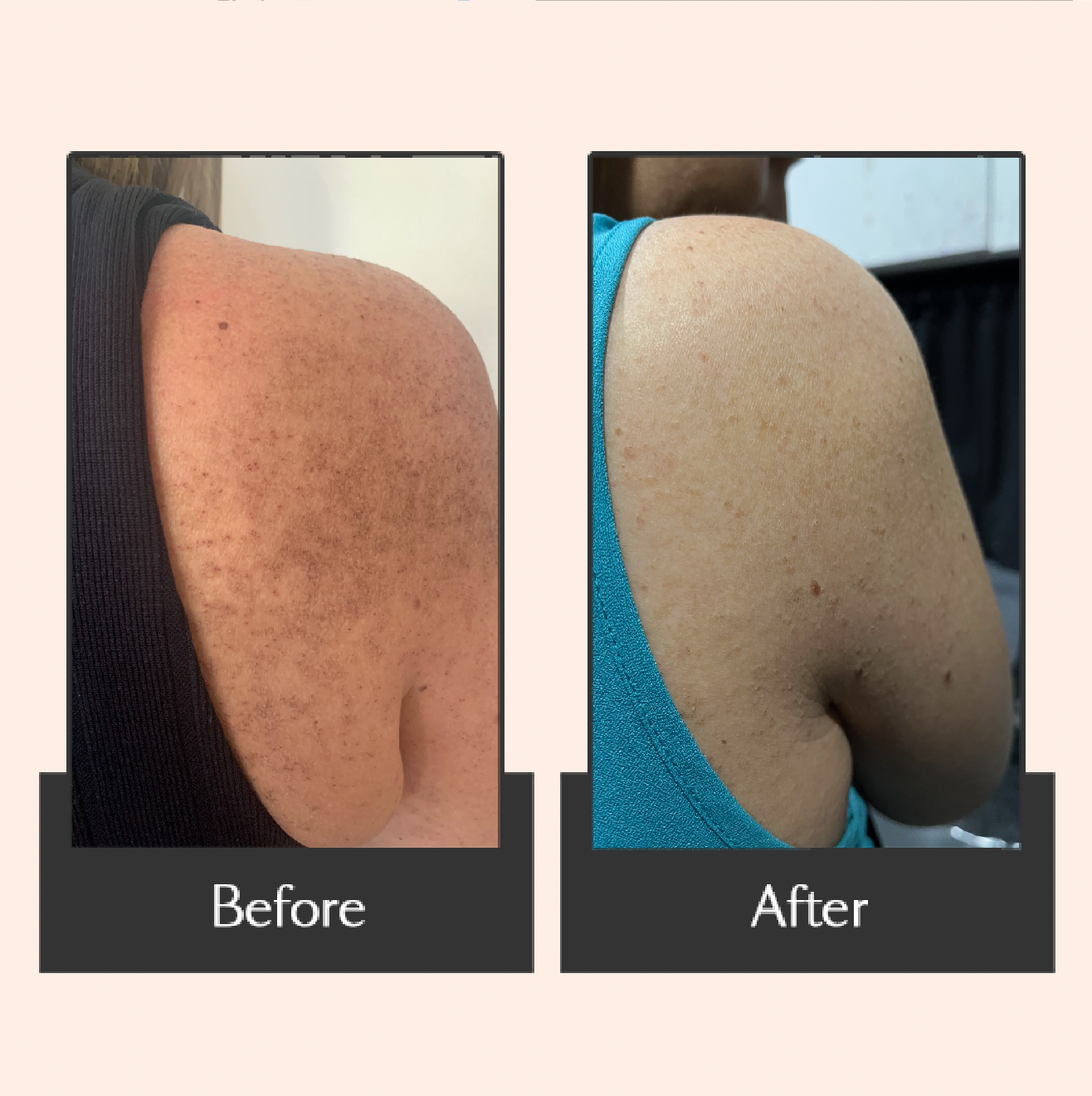 Hair & Body Oil