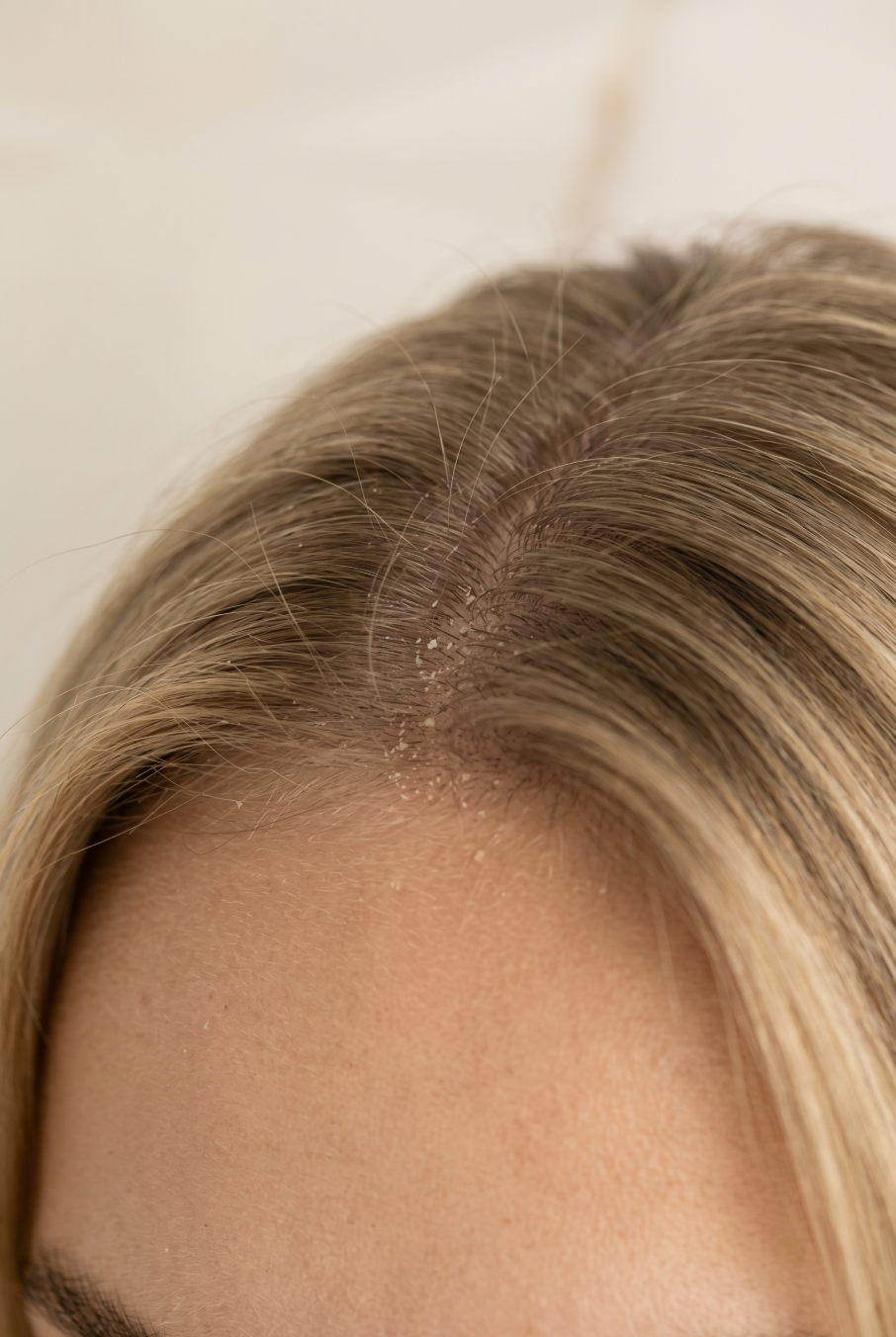 Organic Healing Scalp Oil